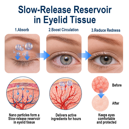 Rekulo® OptiMist Eye Spray✅For dry eyes, blurry vision, eye strain, presbyopia, and cataracts ✨