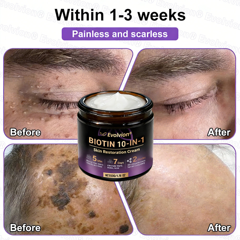 Made and Shipped from UK ✨Evolvion® Biotin 10-in-1 Skin Restoration Cream🌻🌻