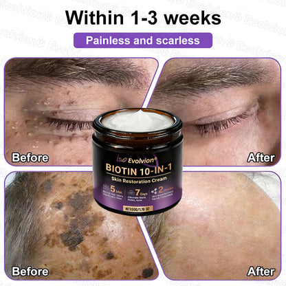 Made and Shipped from UK ✨Evolvion® Biotin 10-in-1 Skin Restoration Cream🌻🌻
