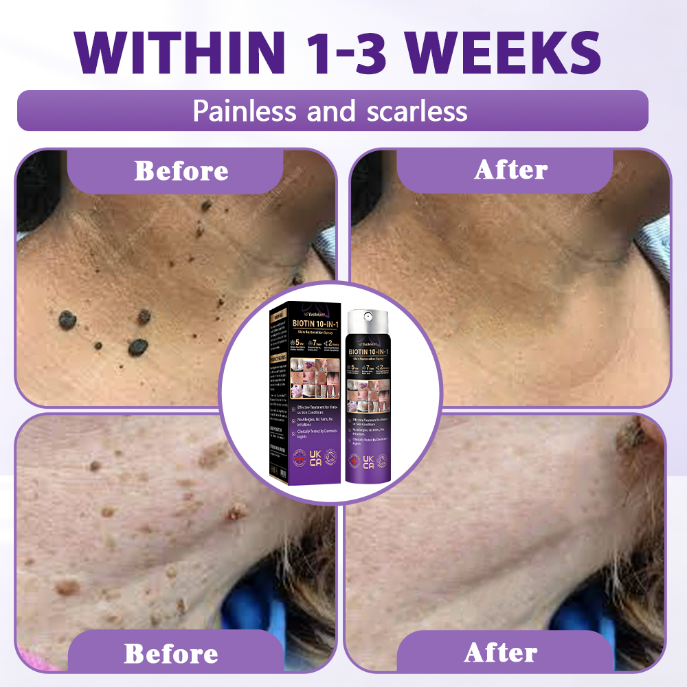 Made and shipped from the United Kingdom ✨Evolvion® Biotin 10-in-1 Skin Restoration Spray✨