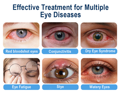 Rekulo® OptiMist Eye Spray✅For dry eyes, blurry vision, eye strain, presbyopia, and cataracts ✨