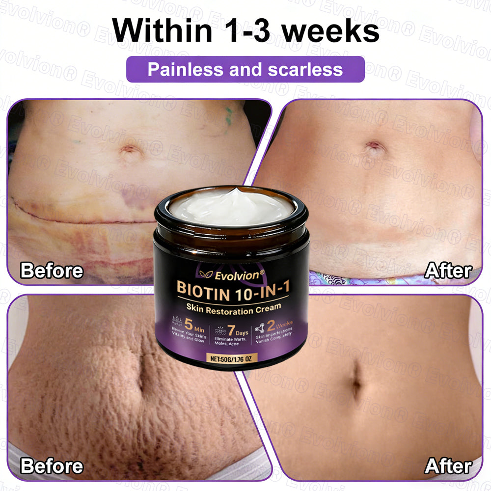 Made and Shipped from UK ✨Evolvion® Biotin 10-in-1 Skin Restoration Cream🌻🌻