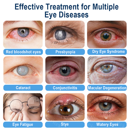 Rekulo® OptiMist Eye Spray✅For dry eyes, blurry vision, eye strain, presbyopia, and cataracts 👀👀