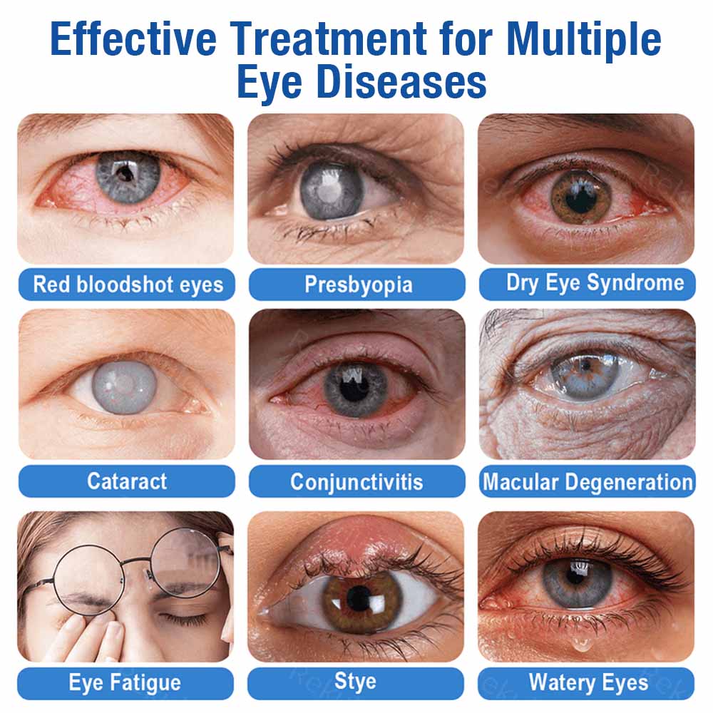 👨‍⚕️ DR.Fachmer® LensClarity Eye Drops✅For dry eyes, blurry vision & presbyopia