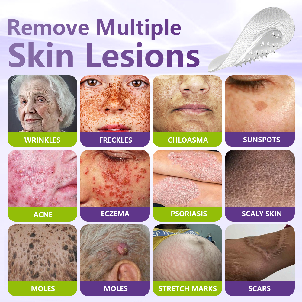 GFOUK® Soluble Microneedle Botanical Skin Tag Removal Patch up