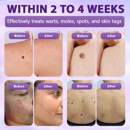 Made and shipped from the United Kingdom ✨Evolvion® Biotin 10-in-1 Skin Restoration Spray✨
