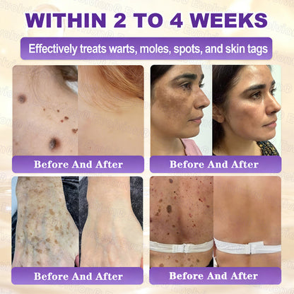 Made and Shipped from UK ✨Evolvion® Biotin 10-in-1 Skin Restoration Cream🌻🌻