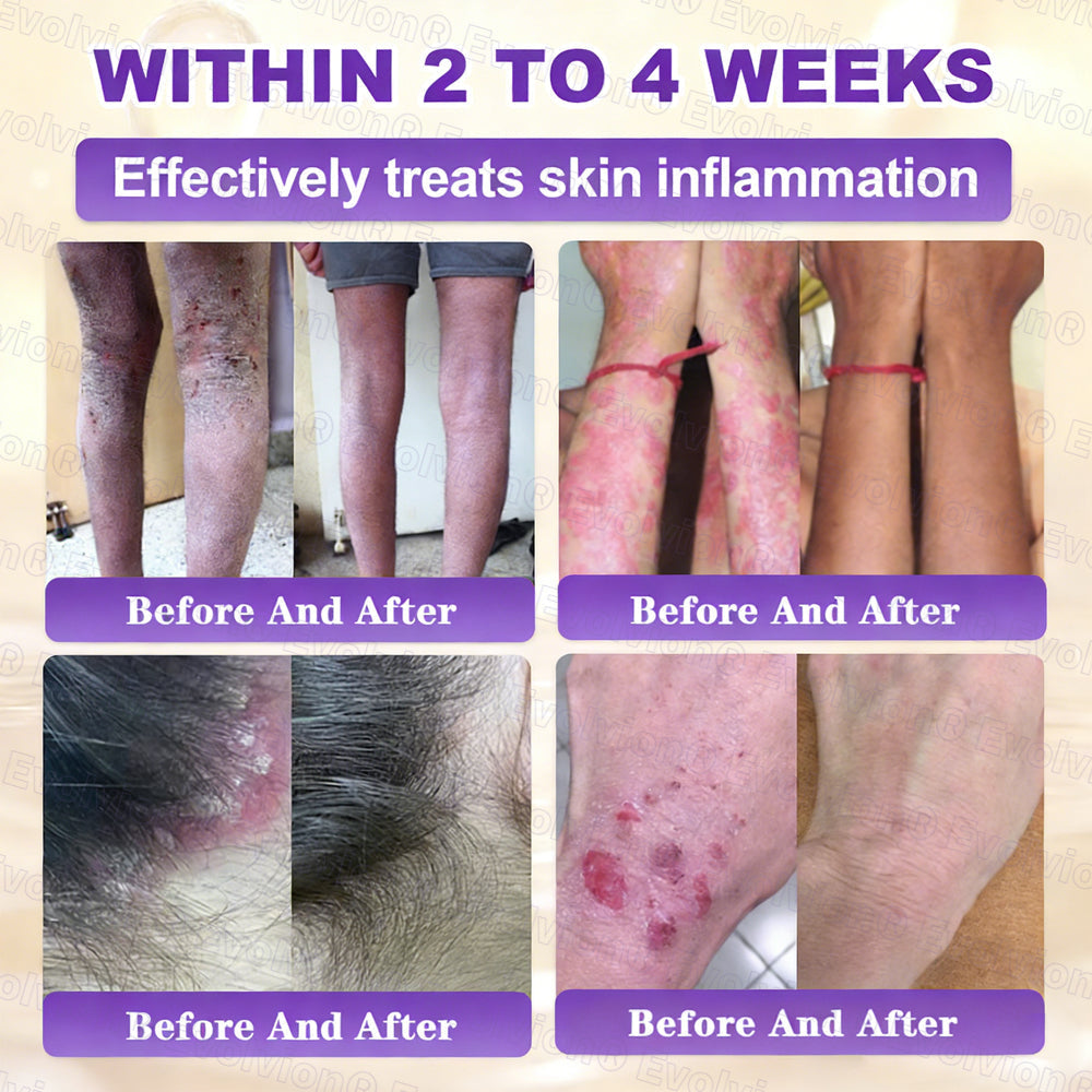 Made and Shipped from UK ✨Evolvion® Biotin 10-in-1 Skin Restoration Cream🌻🌻