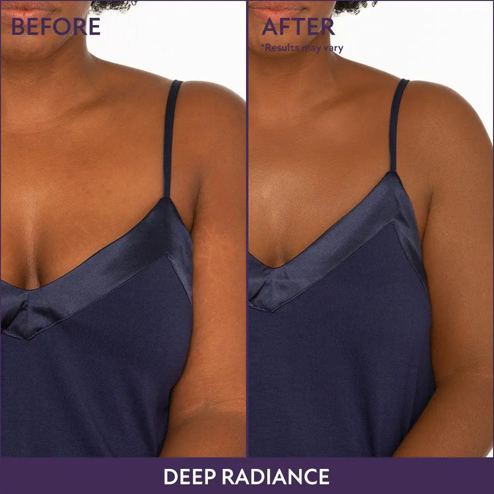 Rolimey® Body Coverage Perfector ✨Suitable for covering scars, spots, veins, tattoos, and other imperfections