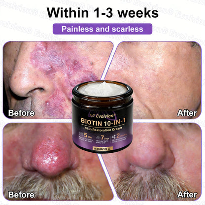 Made and Shipped from UK ✨Evolvion® Biotin 10-in-1 Skin Restoration Cream🌻🌻