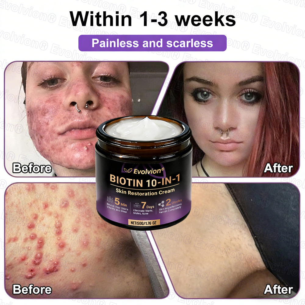 Made and Shipped from UK ✨Evolvion® Biotin 10-in-1 Skin Restoration Cream🌻🌻