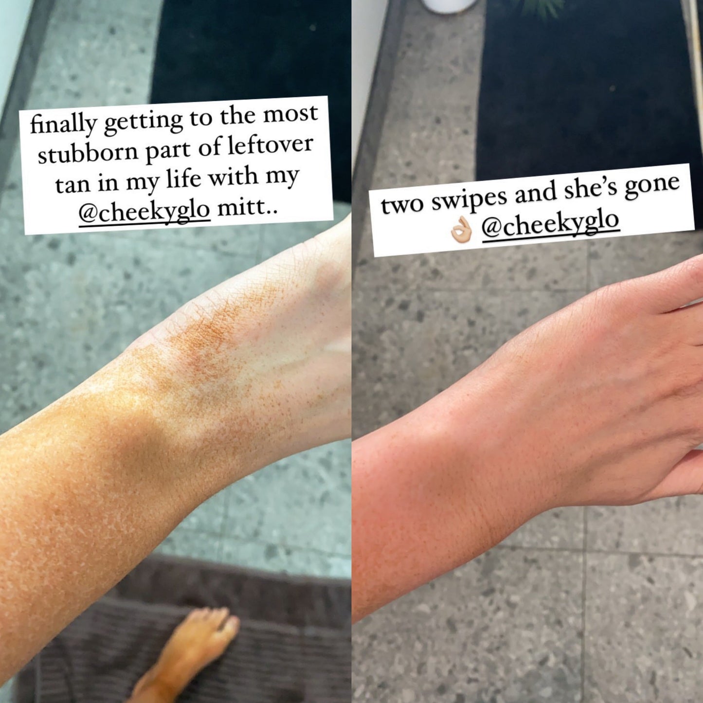 🎄Sugoola® Glow Exfoliating Glove ✨Helps with Dullness, Dryness, Chicken Skin & Uneven Tone