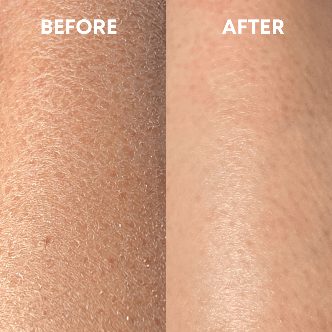 🎄Sugoola® Glow Exfoliating Glove ✨Helps with Dullness, Dryness, Chicken Skin & Uneven Tone