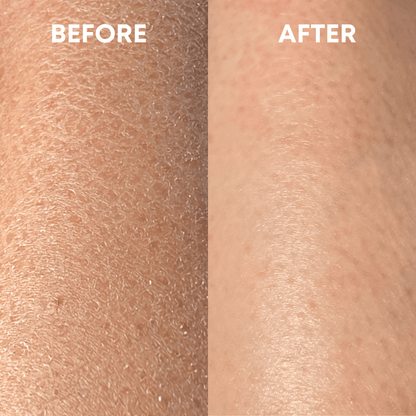 🎄Sugoola® Glow Exfoliating Glove ✨Helps with Dullness, Dryness, Chicken Skin & Uneven Tone