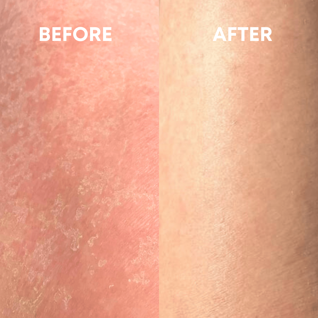 🎄Sugoola® Glow Exfoliating Glove ✨Helps with Dullness, Dryness, Chicken Skin & Uneven Tone
