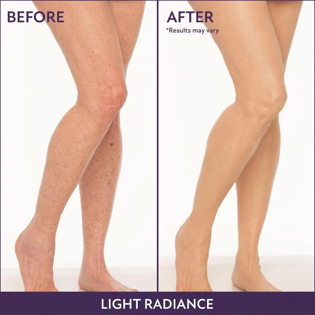 Rolimey® Body Coverage Perfector ✨Suitable for covering scars, spots, veins, tattoos, and other imperfections